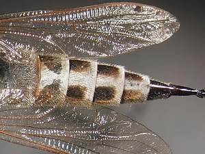 abdomen dorsal