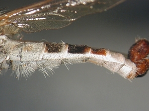 abdomen lateral