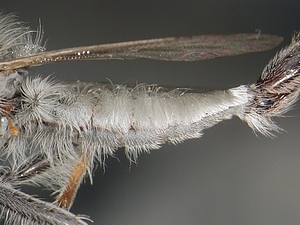 abdomen lateral