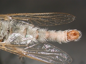 abdomen dorsal