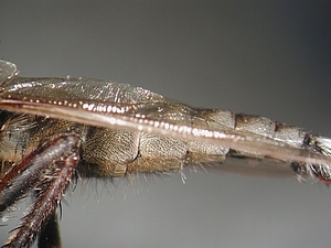 abdomen lateral