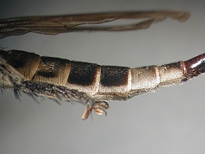 abdomen lateral