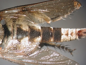 abdomen dorsal