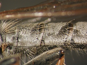 abdomen lateral