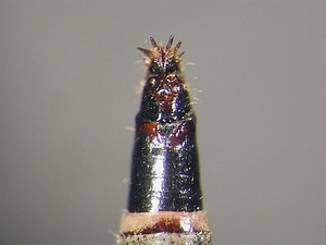 ovipositor dorsal