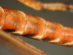 abdomen dorsal