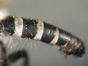 abdomen lateral