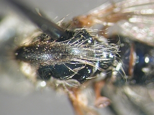 thorax dorsal