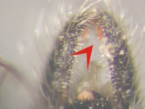 bristles along mesal margin of epandrium