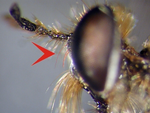 upper part of face with only a single row of hairs along eye margin