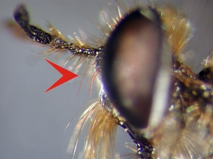 upper part of face with only a single row of hairs along eye margin