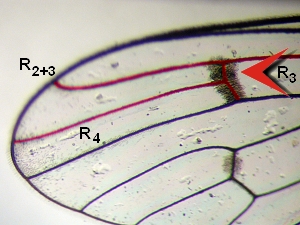 Vein R3 present as a stump vein