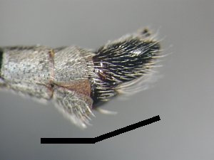 abdomen lateral